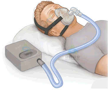 CPAP Hose Cleaning Brush Helps You Thoroughly Clean The Ventilator - AOQUN